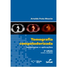 Tomografia computadorizada