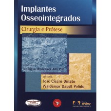 Implantes Osseointegrados