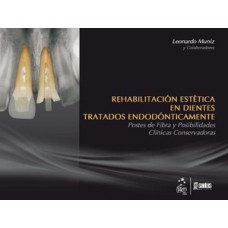 Rehabilitación estética en dientes tratados endodónticamente