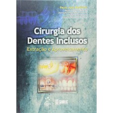 Cirurgia dos dentes inclusos