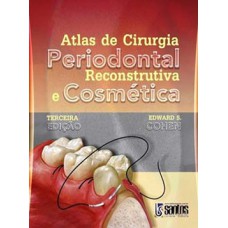 Atlas de cirurgia periodontal reconstrutiva e cosmética