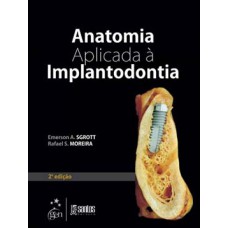 Anatomia aplicada à implantodontia