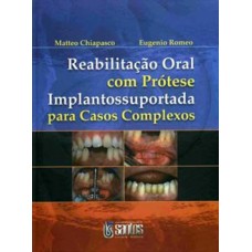 Reabilitação oral com prótese implantossuportada para casos complexos