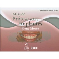 Atlas de prótese sobre implantes