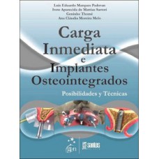 Carga inmediata e implantes osteointegrados