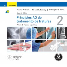 Princípios AO do Tratamento de Fraturas