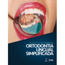 Ortodontia lingual simplificada