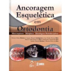 Ancoragem esquelética em ortodontia