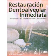 Restauración dentoalveolar inmediata