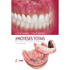 Clonagem terapêutica para próteses totais e overdentures