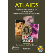 ATLAIDS