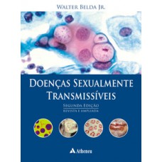 Doenças sexualmente transmissíveis