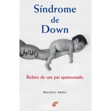 Síndrome de Down