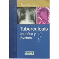Tuberculosis en niños y jóvenes