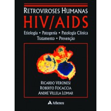 Retroviroses humanas HIV/AIDS