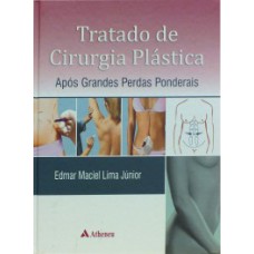 Tratado de cirurgia plástica após grandes perdas ponderais