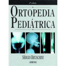 Ortopedia pediátrica