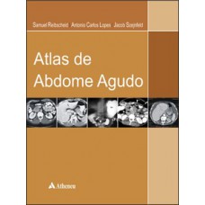 Atlas de abdome agudo