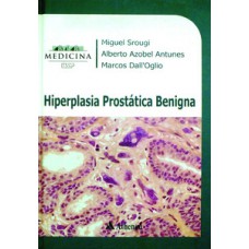 Hiperplasia prostática benigna