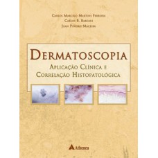 Dermatoscopia