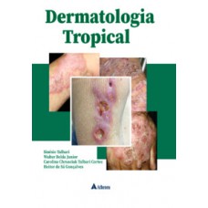 Dermatologia tropical