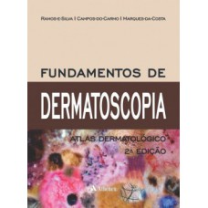 Fundamentos de dermatoscopia