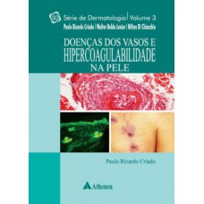 Doenças dos vasos e hipercoagulabilidade na pele