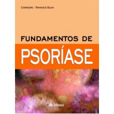 Fundamentos de psoríase