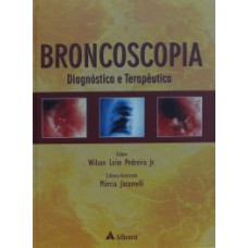 Broncoscopia