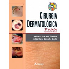 Cirurgia dermatologica