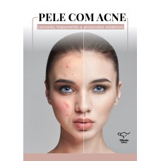 Pele com acne