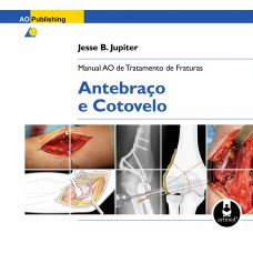 Manual AO de Tratamento de Fraturas