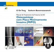 Manual de Tratamento de Fraturas da AO