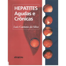 Hepatites agudas e crônicas