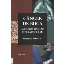 Câncer de boca