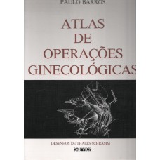 Atlas de operações ginecológicas