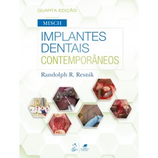 Misch - Implantes Dentais Contemporâneos