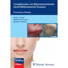 Complicações em Rejuvenescimento Facial Minimamente Invasivo