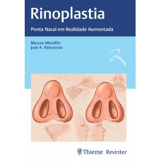 Rinoplastia