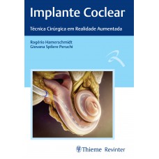 Implante Coclear