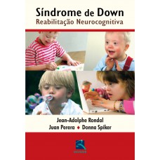 Síndrome de Down