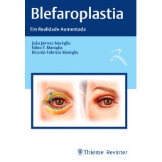 Blefaroplastia