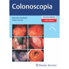 Colonoscopia