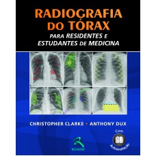 Radiografia do Tórax