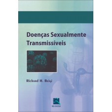 Doenças Sexualmente Transmissíveis