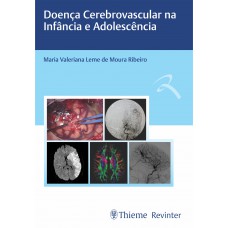 Doença Cerebrovascular na Infância e Adolescência