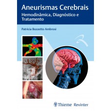 Aneurismas Cerebrais