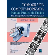 Tomografia Computadorizada