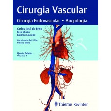 Cirurgia Vascular