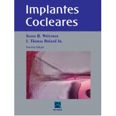 Implantes Cocleares